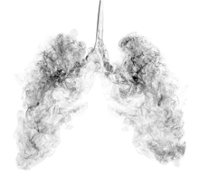 Lung_Smoke_202 Lung_Smoke_202